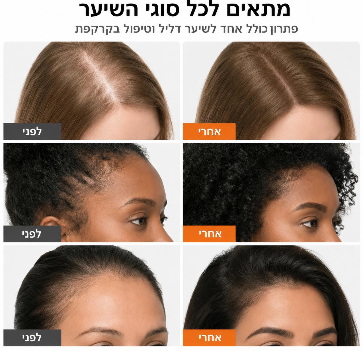 המברשת המטפלת של ByLumi