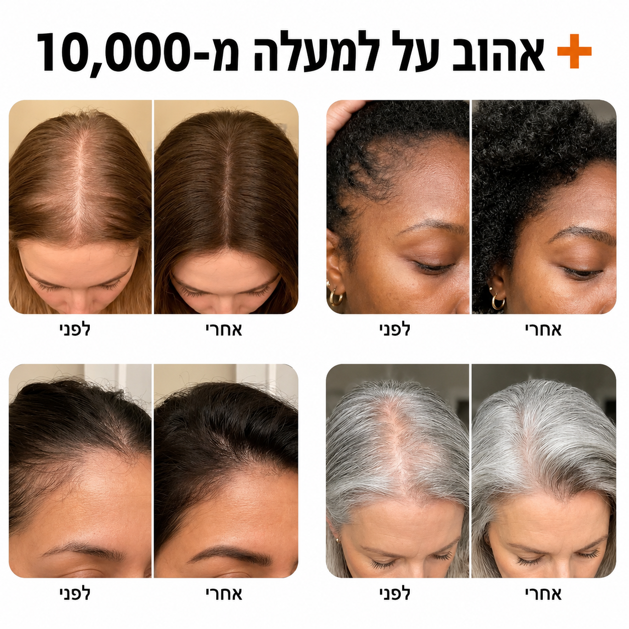 המברשת המטפלת של ByLumi